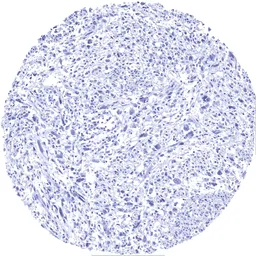 Anti-MyoD1 antibody [MSVA-801R] HistoMAX&trade; used in IHC (Paraffin sections) (IHC-P). GTX04419