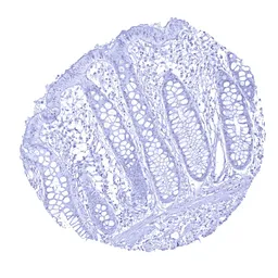 Anti-MyoD1 antibody [MSVA-801R] HistoMAX&trade; used in IHC (Paraffin sections) (IHC-P). GTX04419