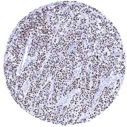 Anti-MyoD1 antibody [MSVA-801R] HistoMAX&trade; used in IHC (Paraffin sections) (IHC-P). GTX04419