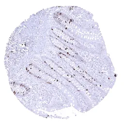Anti-Topoisomerase II alpha antibody [MSVA-802R] HistoMAX&trade; used in IHC (Paraffin sections) (IHC-P). GTX04422