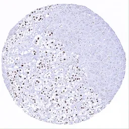 Anti-INSM1 antibody [MSVA-456R] HistoMAX&trade; used in IHC (Paraffin sections) (IHC-P). GTX04423