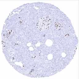 Anti-INSM1 antibody [MSVA-456R] HistoMAX&trade; used in IHC (Paraffin sections) (IHC-P). GTX04423
