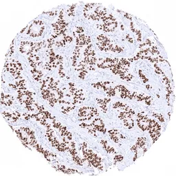 Anti-INSM1 antibody [MSVA-456R] HistoMAX&trade; used in IHC (Paraffin sections) (IHC-P). GTX04423