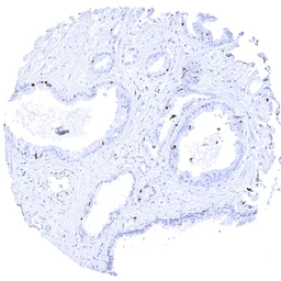 Anti-MCM3 antibody [MSVA-503M] HistoMAX&trade; used in IHC (Paraffin sections) (IHC-P). GTX04424