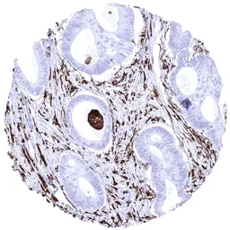 Anti-HLA-DRA antibody [MSVA-470R] HistoMAX&trade; used in IHC (Paraffin sections) (IHC-P). GTX04429