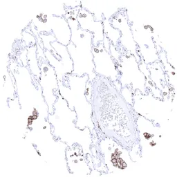Anti-TIM-3 antibody [MSVA-366R] HistoMAX&trade; used in IHC (Paraffin sections) (IHC-P). GTX04440