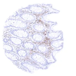 Anti-TIM-3 antibody [MSVA-366R] HistoMAX&trade; used in IHC (Paraffin sections) (IHC-P). GTX04440