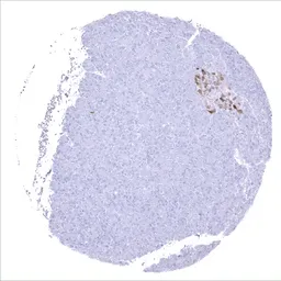 Anti-CDKN2A / p16INK4a antibody [MSVA-016R] HistoMAX&trade; used in IHC (Paraffin sections) (IHC-P). GTX04442