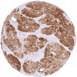 Anti-CDKN2A / p16INK4a antibody [MSVA-016R] HistoMAX&trade; used in IHC (Paraffin sections) (IHC-P). GTX04442