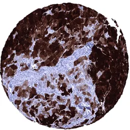 Anti-L-FABP antibody [MSVA-501M] HistoMAX&trade; used in IHC (Paraffin sections) (IHC-P). GTX04448