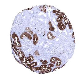 Anti-L-FABP antibody [MSVA-501M] HistoMAX&trade; used in IHC (Paraffin sections) (IHC-P). GTX04448
