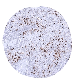 Anti-S100A12 antibody [MSVA-812M] HistoMAX&trade; used in IHC (Paraffin sections) (IHC-P). GTX04449