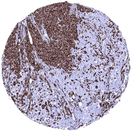 Anti-S100A12 antibody [MSVA-812M] HistoMAX&trade; used in IHC (Paraffin sections) (IHC-P). GTX04449