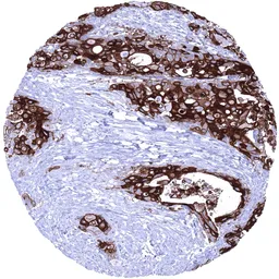 Anti-UPK1B antibody [MSVA-734M] HistoMAX&trade; used in IHC (Paraffin sections) (IHC-P). GTX04450