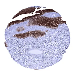 Anti-UPK1B antibody [MSVA-734M] HistoMAX&trade; used in IHC (Paraffin sections) (IHC-P). GTX04450