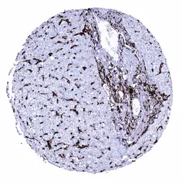 Anti-HLA-DRB1 antibody [MSVA-478R] HistoMAX&trade; used in IHC (Paraffin sections) (IHC-P). GTX04457