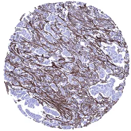 Anti-Periostin antibody [MSVA-649M] HistoMAX&trade; used in IHC (Paraffin sections) (IHC-P). GTX04460