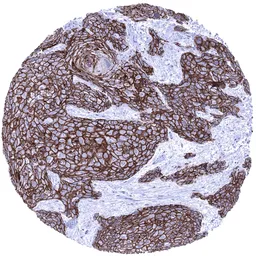 Anti-Desmoglein 3 antibody [MSVA-543M] HistoMAX&trade; used in IHC (Paraffin sections) (IHC-P). GTX04468