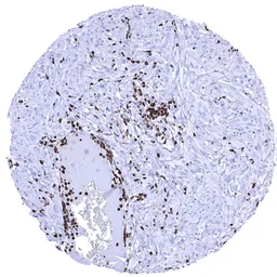 Anti-Myeloperoxidase antibody [MSVA-692M] HistoMAX&trade; used in IHC (Paraffin sections) (IHC-P). GTX04470