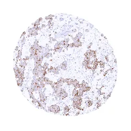 Anti-UPK3B antibody [MSVA-736M] HistoMAX&trade; used in IHC (Paraffin sections) (IHC-P). GTX04476