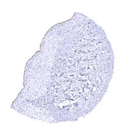 Anti-UPK3B antibody [MSVA-736M] HistoMAX&trade; used in IHC (Paraffin sections) (IHC-P). GTX04476