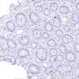 Anti-Helicobacter pylori Catalase antibody [MSVA-466M] HistoMAX&trade; used in IHC (Paraffin sections) (IHC-P). GTX04479