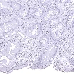 Anti-Helicobacter pylori Catalase antibody [MSVA-466M] HistoMAX&trade; used in IHC (Paraffin sections) (IHC-P). GTX04479