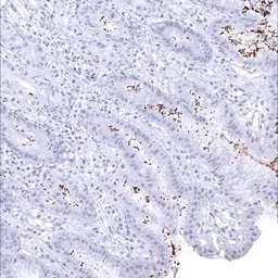 Anti-Helicobacter pylori Catalase antibody [MSVA-466M] HistoMAX&trade; used in IHC (Paraffin sections) (IHC-P). GTX04479