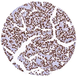 Anti-NKX2.1 antibody [MSVA-312R] HistoMAX&trade; used in IHC (Paraffin sections) (IHC-P). GTX04489