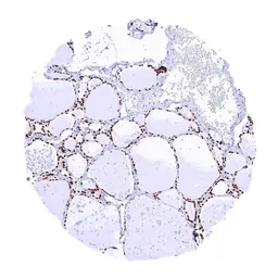 Anti-NKX2.1 antibody [MSVA-312R] HistoMAX&trade; used in IHC (Paraffin sections) (IHC-P). GTX04489