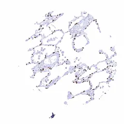 Anti-NKX2.1 antibody [MSVA-312R] HistoMAX&trade; used in IHC (Paraffin sections) (IHC-P). GTX04489