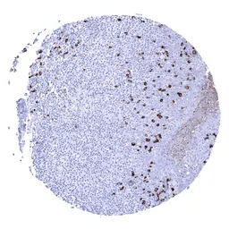 Anti-Rabbit anti-human IgA antibody [MSVA-700R] HistoMAX&trade; used in IHC (Paraffin sections) (IHC-P). GTX04490