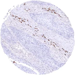Anti-Rabbit anti-human IgA antibody [MSVA-700R] HistoMAX&trade; used in IHC (Paraffin sections) (IHC-P). GTX04490