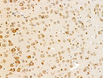 Anti-OMP antibody used in IHC (Paraffin sections) (IHC-P). GTX04493