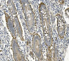 Anti-Integrin beta 4 antibody used in IHC (Paraffin sections) (IHC-P). GTX04496