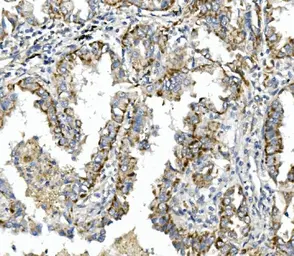 Anti-Integrin beta 4 antibody used in IHC (Paraffin sections) (IHC-P). GTX04496