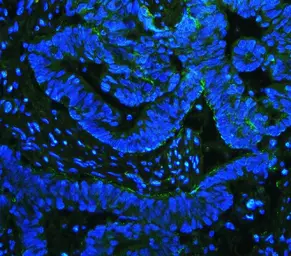 Anti-Integrin beta 4 antibody used in IHC (Paraffin sections) (IHC-P). GTX04496
