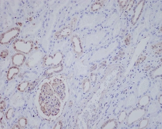 Anti-ALK antibody [20A85] used in IHC (Paraffin sections) (IHC-P). GTX04501