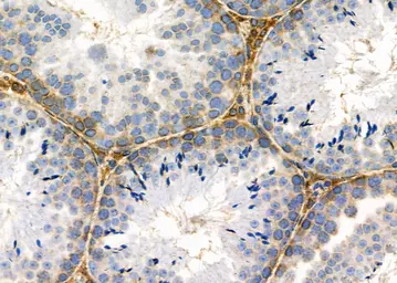 Anti-NUR77 antibody used in IHC (Paraffin sections) (IHC-P). GTX04510