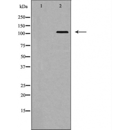 Anti-EphA5 antibody used in Western Blot (WB). GTX04513
