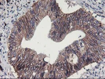 Anti-ALOX15 antibody [OTI3G8] used in IHC (Paraffin sections) (IHC-P). GTX04520