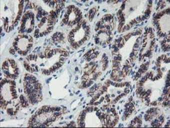 Anti-ALOX15 antibody [OTI3G8] used in IHC (Paraffin sections) (IHC-P). GTX04520