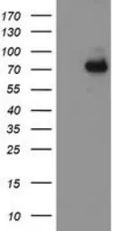 Anti-ALOX15 antibody [OTI3G8] used in Western Blot (WB). GTX04520