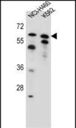 Anti-PLAG1 antibody used in Western Blot (WB). GTX04521