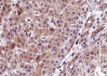 Anti-PERK (phospho Thr982) antibody used in IHC (Paraffin sections) (IHC-P). GTX04533