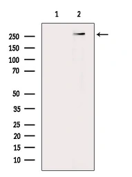 Anti-FAM38A antibody used in Western Blot (WB). GTX04534