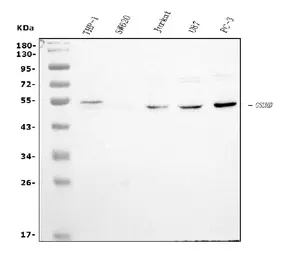 Anti-Gasdermin D antibody [6D11] used in Western Blot (WB). GTX04538