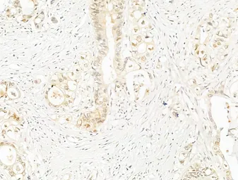 Anti-NFkB p65 (phospho Ser276) antibody used in IHC (Paraffin sections) (IHC-P). GTX04541