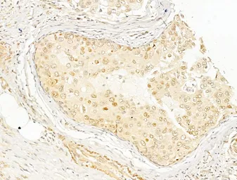 Anti-NFkB p65 (phospho Ser276) antibody used in IHC (Paraffin sections) (IHC-P). GTX04541