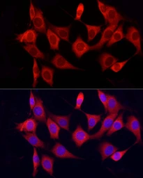 Anti-CYP7B1 antibody used in Immunocytochemistry/ Immunofluorescence (ICC/IF). GTX04545